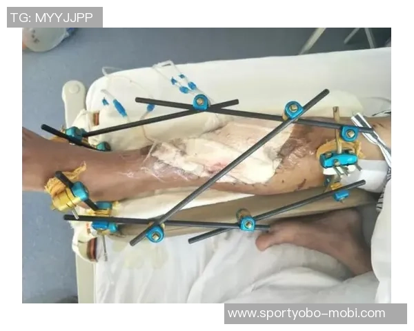 弗兰克透露比尔骨折如同车祸这并非常见篮球伤病 弗兰克透露比尔骨折如同车祸这并非常见篮球伤病